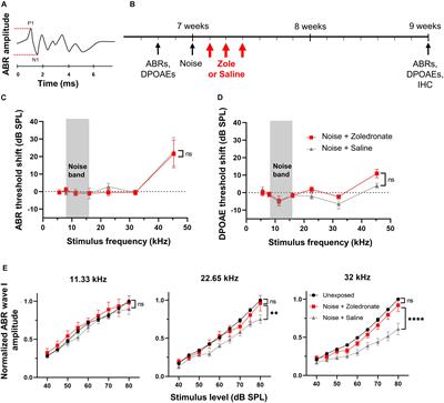 Regeneration of Cochlear Synapses by Systemic Administration of a Bisphosphonate